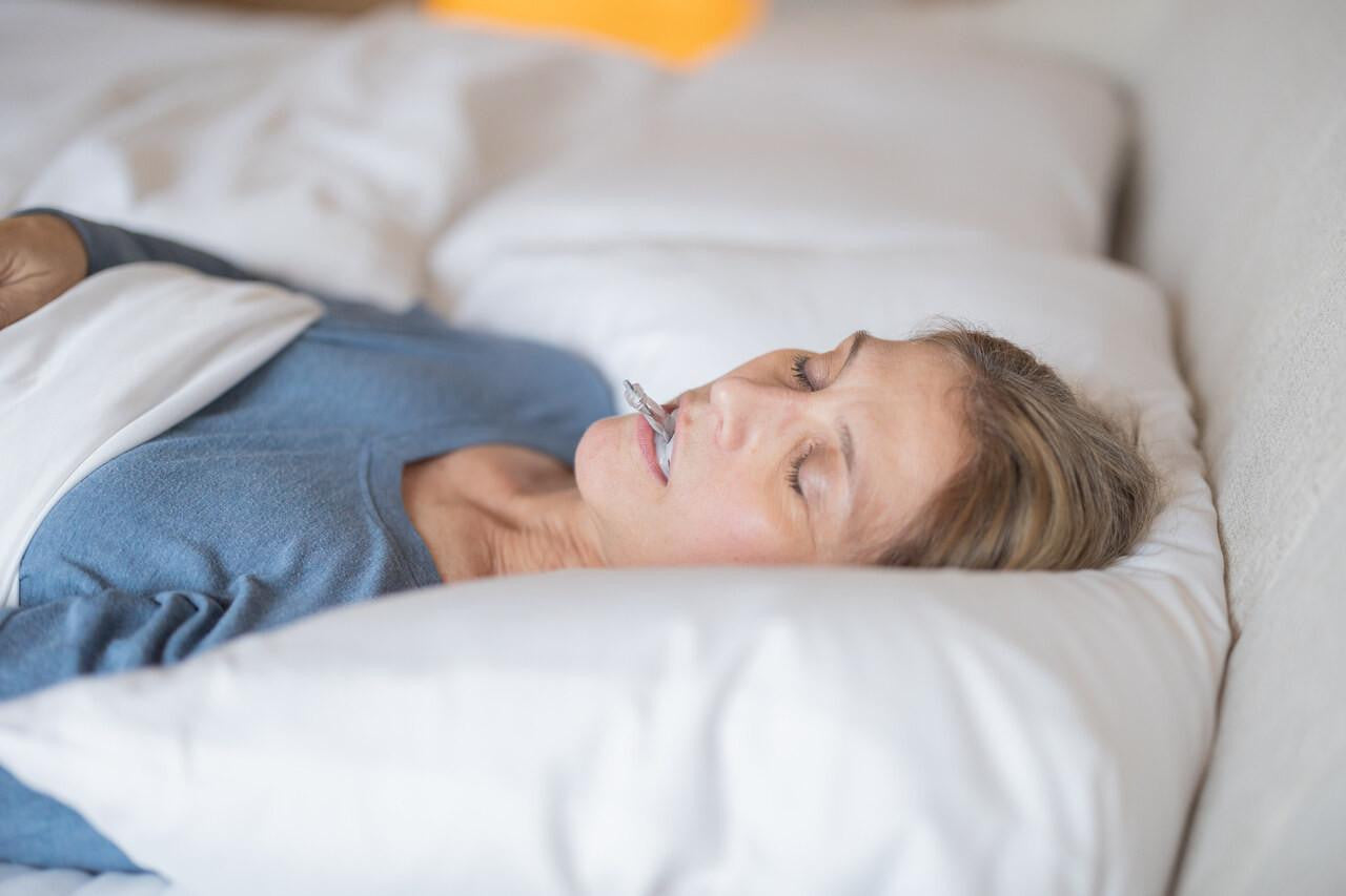 Airway Management MyTAP - Anti snoring oral device (MAD), woman sleeping peacefully with the device in her mouth on a bed.